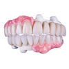 🦷 Trilor Fiber-Reinforced Composite Disk – Superior Strength & Flexibility