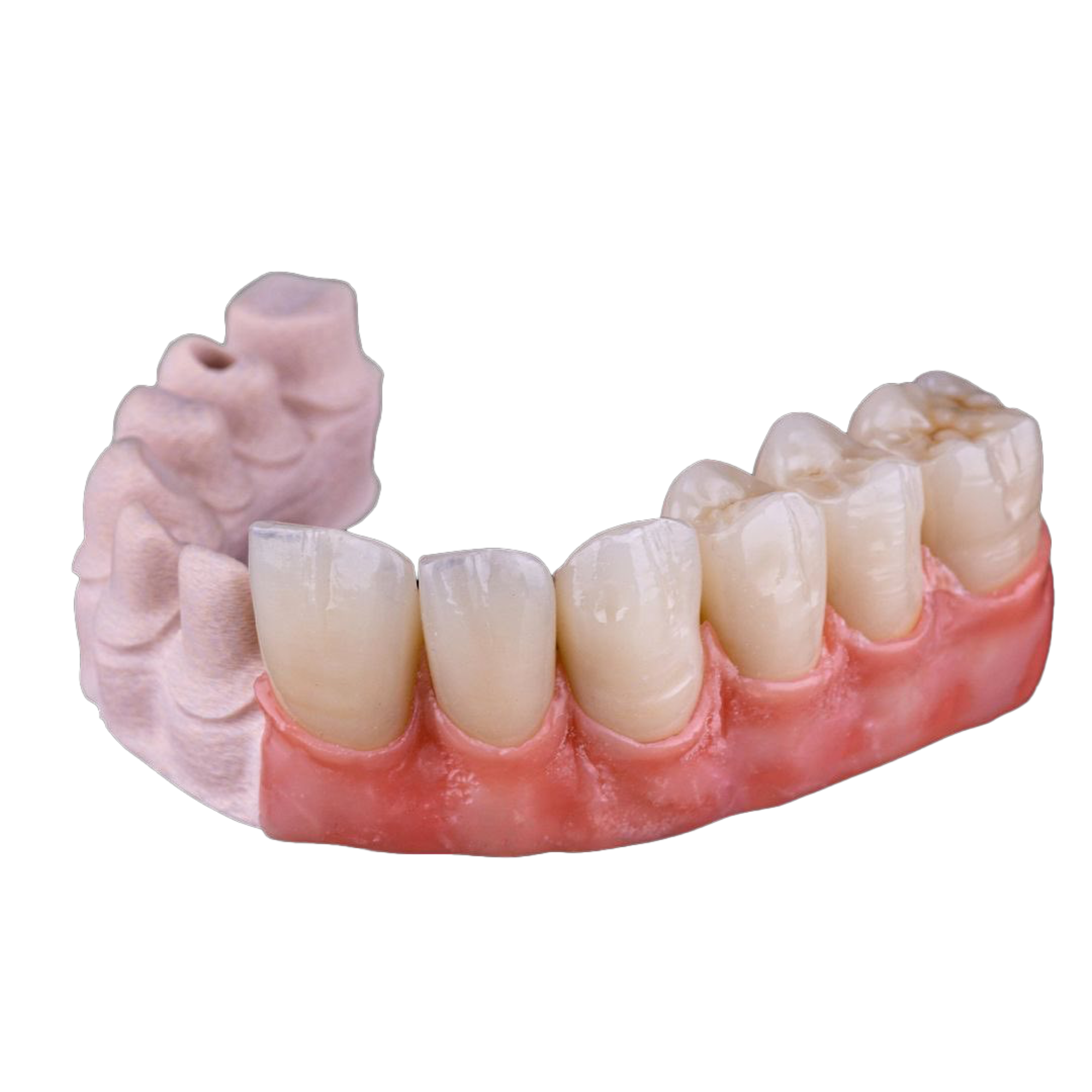 🦷 Trilor Fiber-Reinforced Composite Disk – Superior Strength & Flexibility